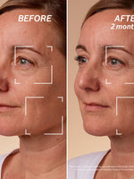 Before & After Using Immortelle Divine Cream