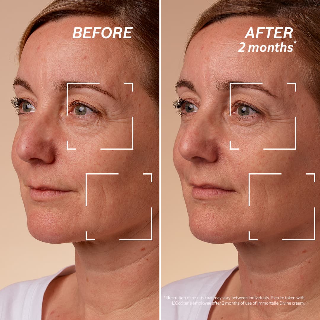 Before & After Using Immortelle Divine Cream