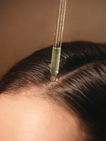 Anti-Hair Loss Treatment