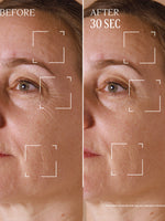 Two pictures of a woman ' s face before and after the procedure - Illustration 5